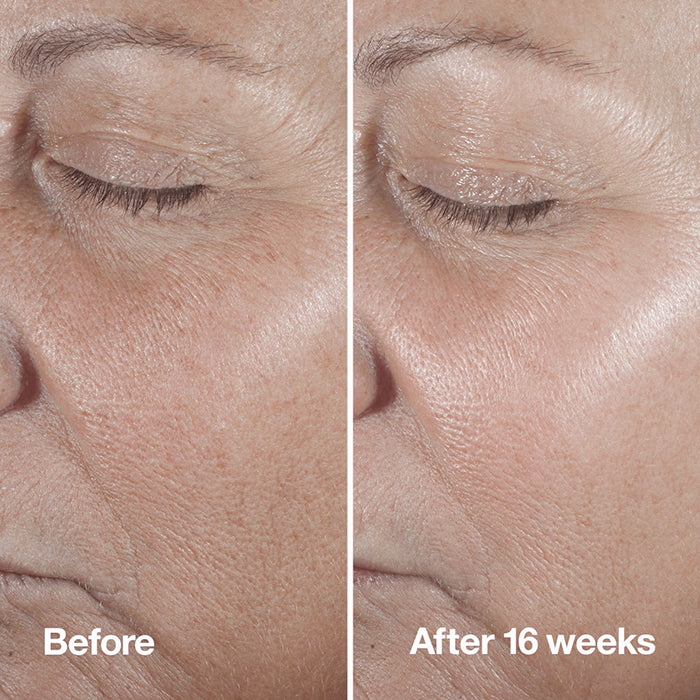 SMART CLINICAL REPAIR™ WRINKLE CORRECTING SERUM FACE SERUM by CLINIQUE at Sundora