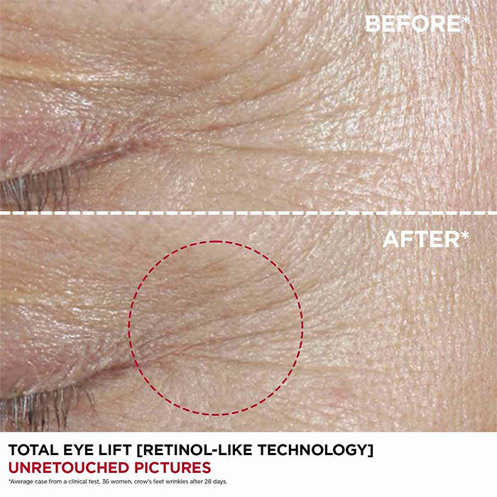 Total Eye Lift Refillable Eye Cream for Firming, Wrinkles, Dark Circles + Puffiness