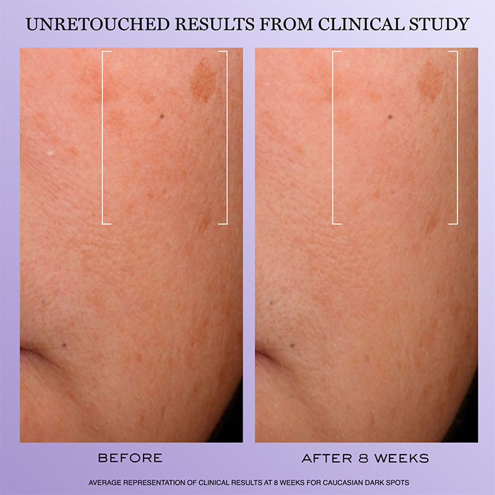 Rénergie H.C.F. Triple Serum 50 ML