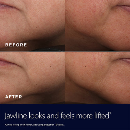 REVITALIZING SUPREME+ MOISTURIZER YOUTH POWER CREME FACE SERUM by ESTÉE LAUDER at Sundora