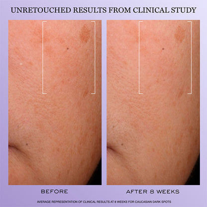 Rénergie H.C.F. Triple Serum 50 ML